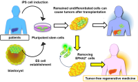 Tackling the hurdle of tumor formation in stem cell therapies