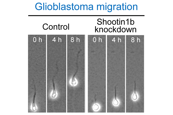 Identifying the Interactions That Drive Cell Migration in Brain Cancer (*external link)
