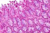 悪玉菌の増殖を抑え、腸内細菌をIgA抗体で制御  ~腸内細菌叢改善薬の開発に道~