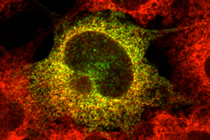 細胞内コミュニケーションにタンパク質合成停止が重要! ~円滑で効率が良い情報伝達の仕組みを解明~
